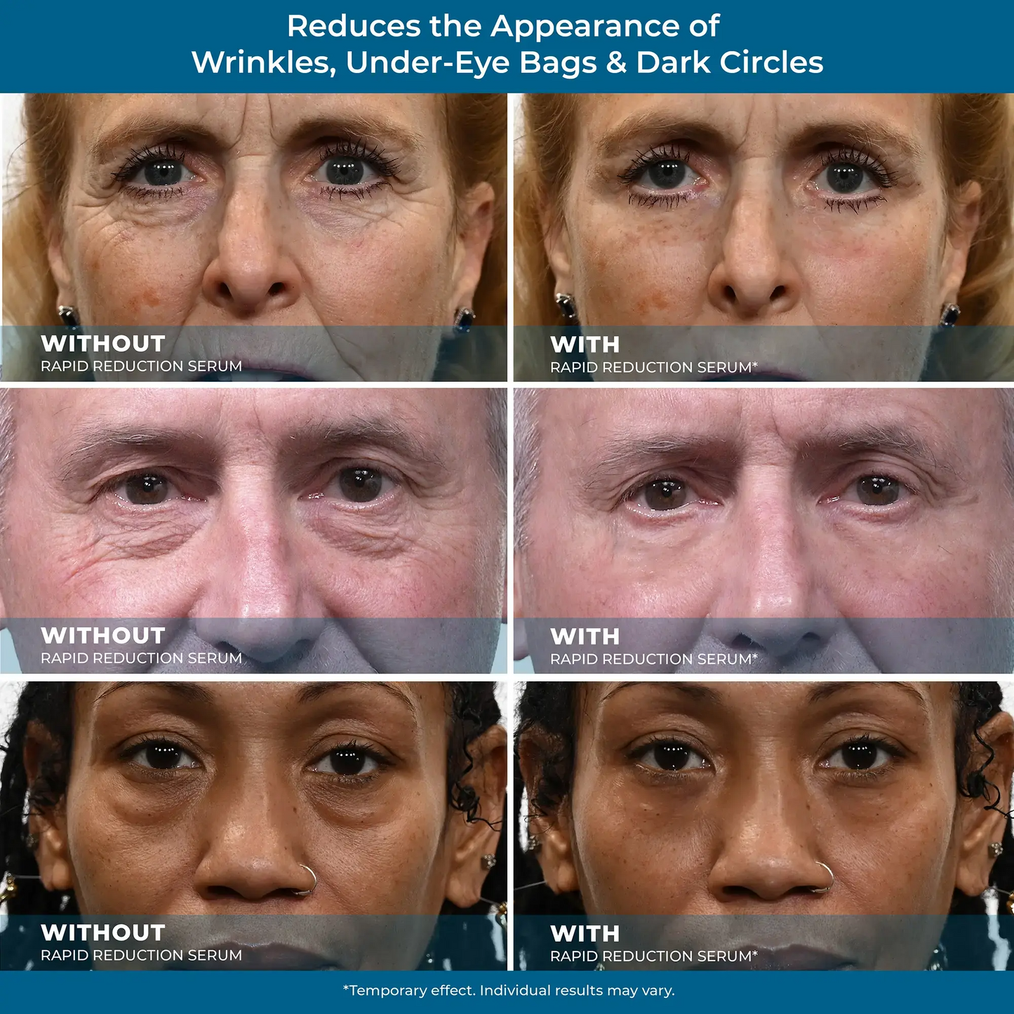 Rapid Reduction Serum -1-Month Supply