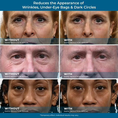 Rapid Reduction Serum -1-Month Supply